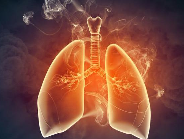 Cổ họng là còi báo động của phổi, ung thư phổi xuất hiện, cổ họng sẽ đưa ra 3 cảnh báo, nếu bạn gặp cả 3 thì 80% bị bệnh rồi - Ảnh 1.